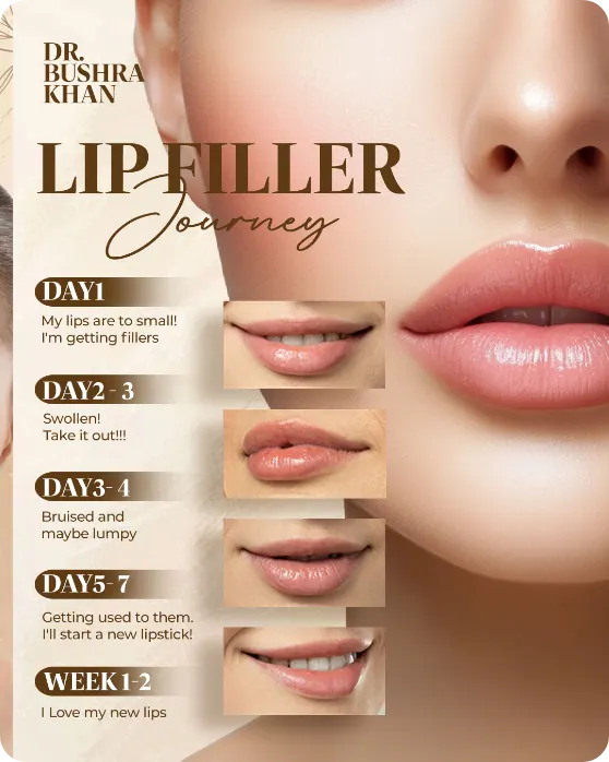 Dr. Bushra Khan post: Lip filler journey